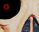 Jitterskull