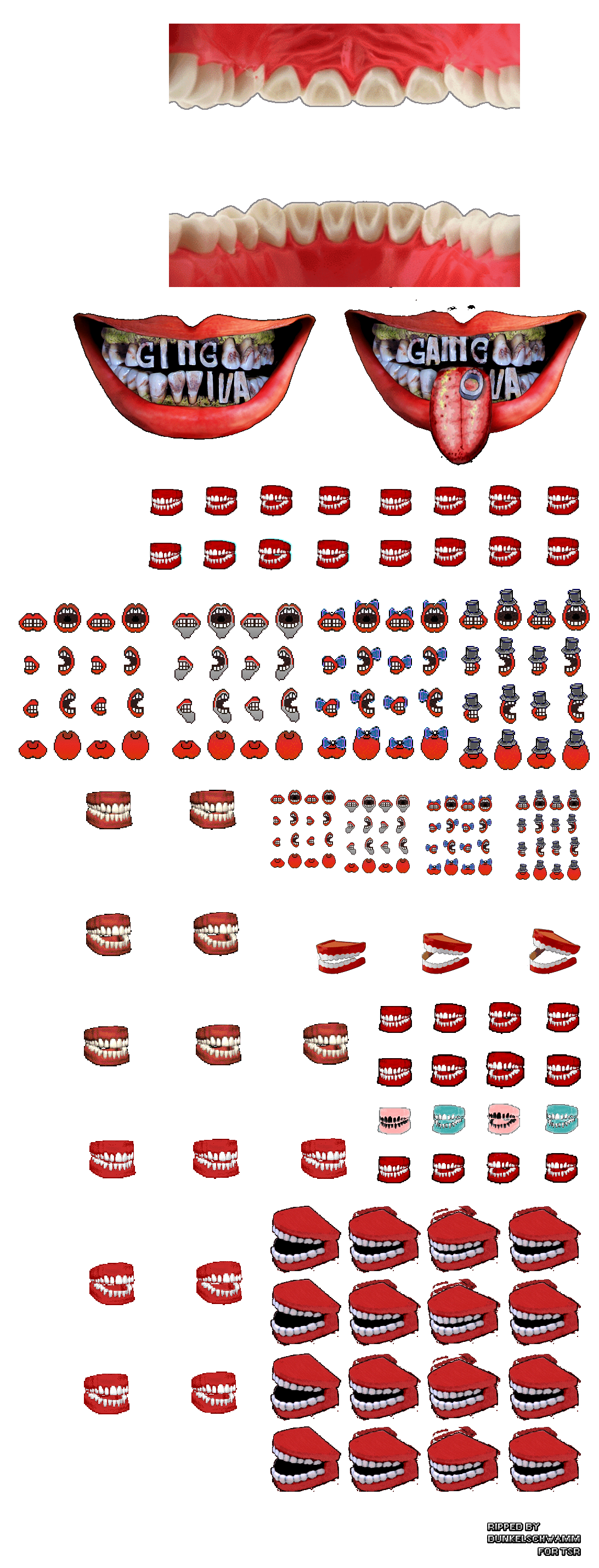 Gingiva - Chatterteeth