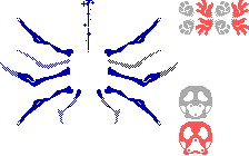 Princess Remedy In A Heap of Trouble - Area 1 Boss